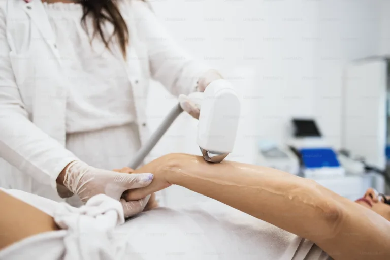 Unleash Confidence with Laser Hair Removal for Arms