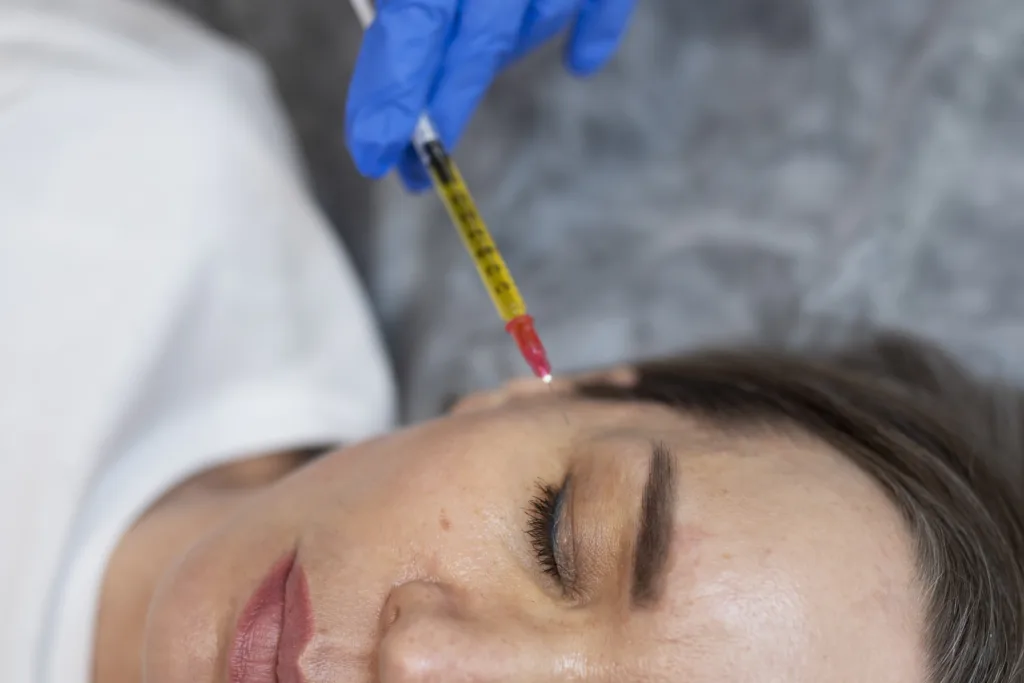 Plasma for Acne Scars: An Effective Treatment Option for Skin Rejuvenation - CharmAdvisor