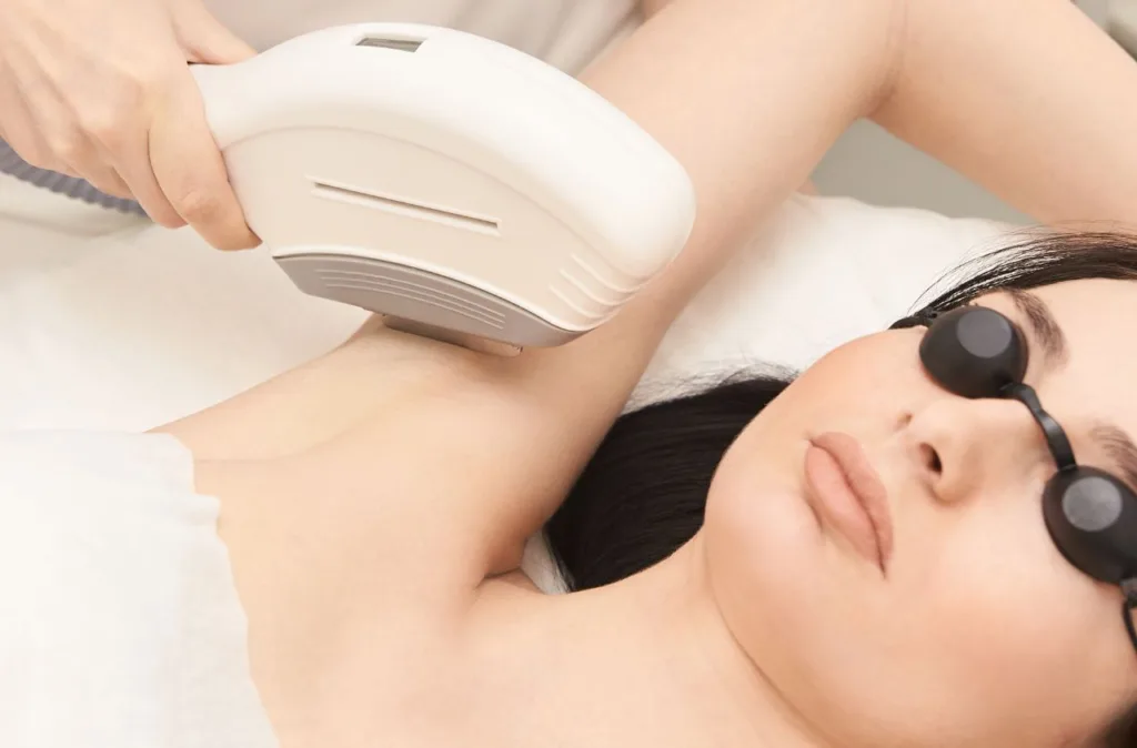 A woman undergoing IPL treatment. Does Laser Hair Removal Remove Dark Spots?